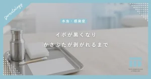 イボに液体窒素を当てて黒くなるのはなぜ？かさぶたが剥がれるまでの正しい経過