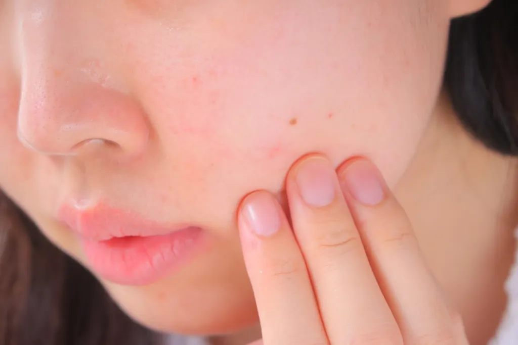 赤みのある頬に指を当てる女性