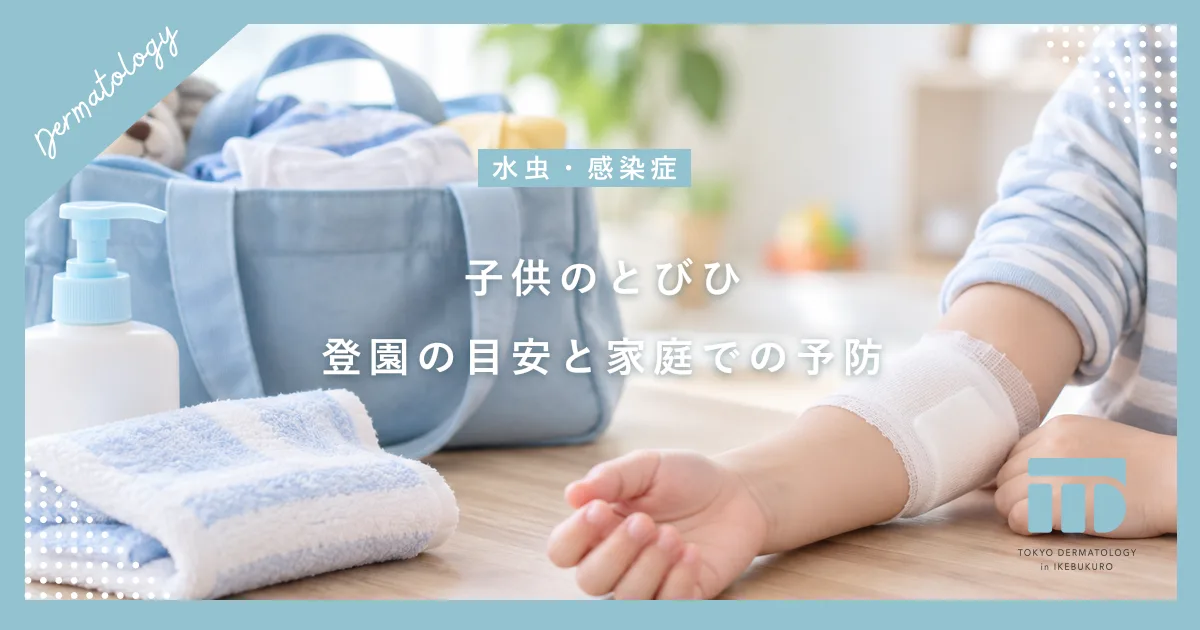 【子供のとびひ対策】保育園・幼稚園はいつから？うつさないための処置と予防