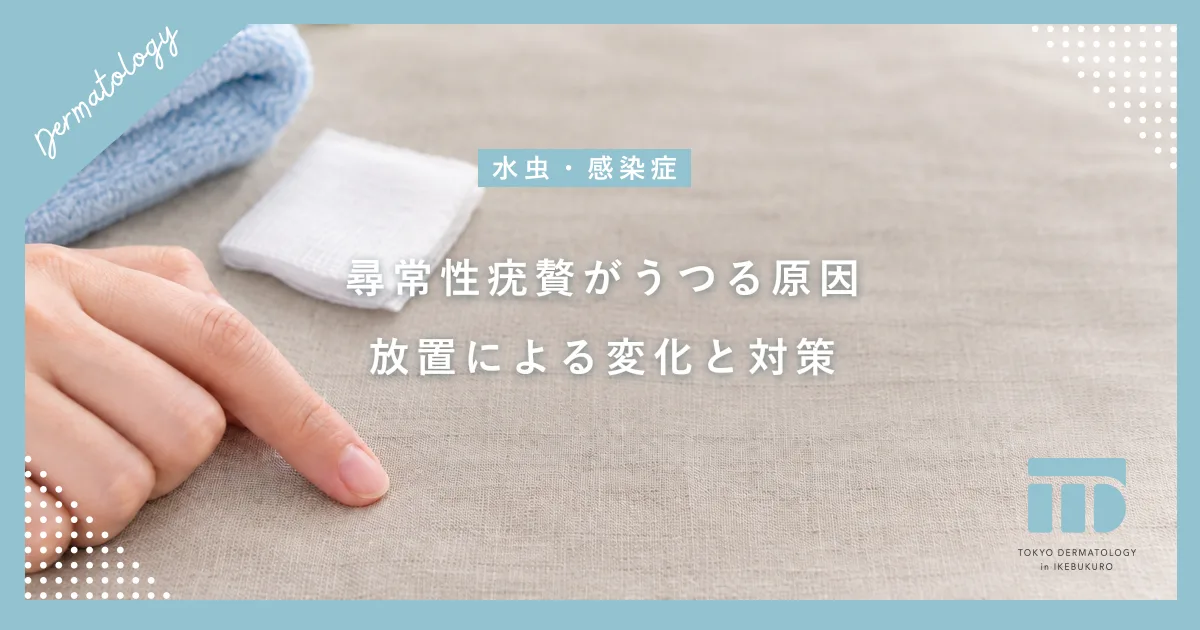 尋常性疣贅(ウイルス性イボ)とは?手足にうつる原因と放置してはいけない理由