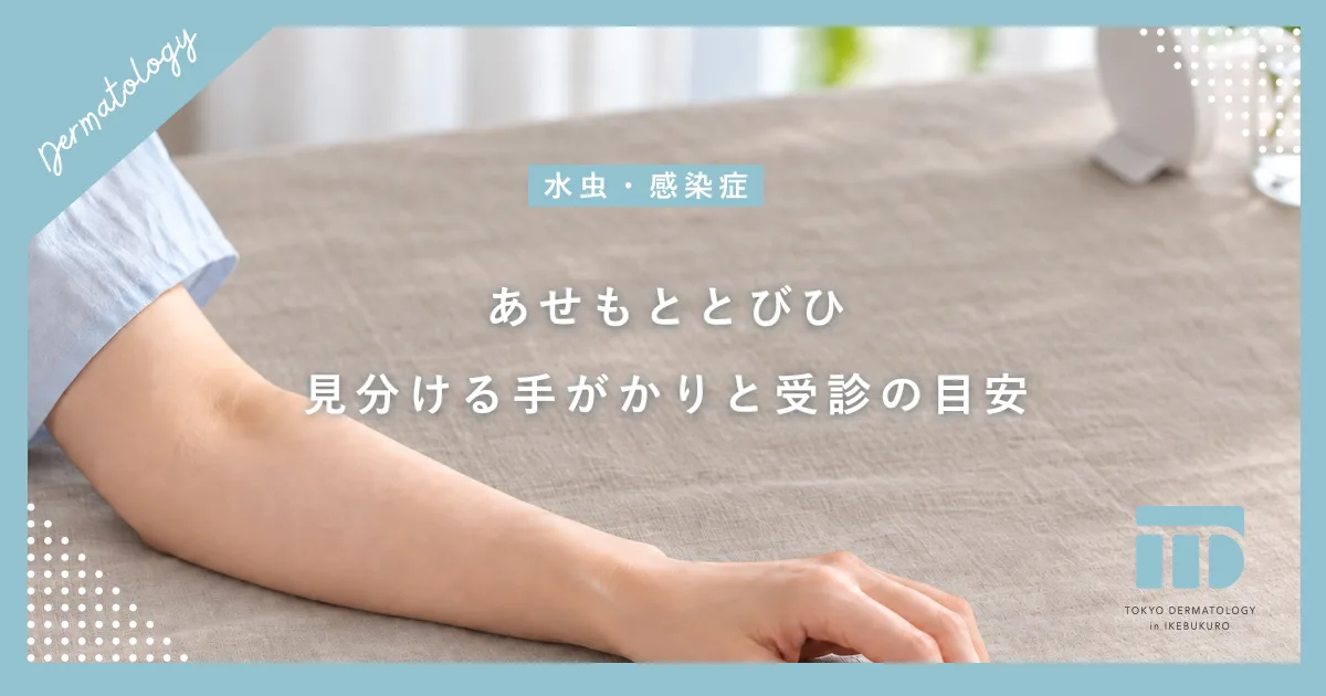 あせもととびひの見分け方は?夏に多い赤みやかゆみの原因と正しい見分け方