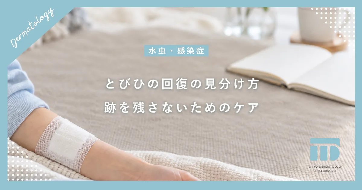 【とびひの治し方まとめ】見分け方のポイントと跡を残さず早く治すステップ