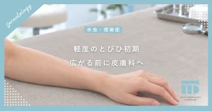 【軽度のとびひ初期】放置は厳禁！水ぶくれが広がる前の早めの皮膚科治療