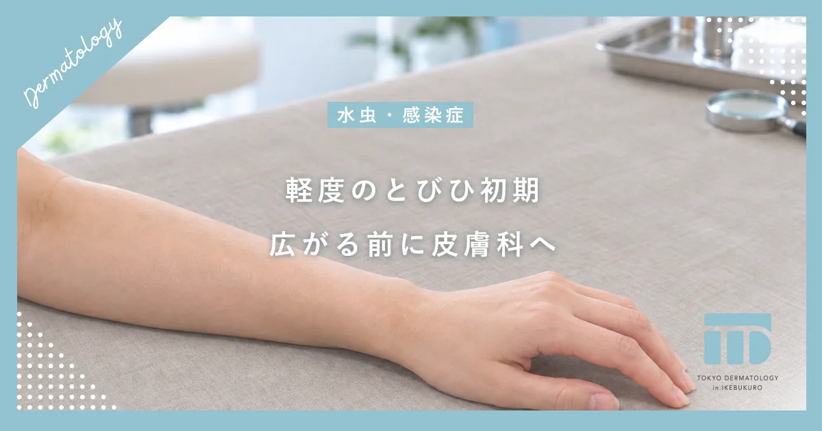 【軽度のとびひ初期】放置は厳禁!水ぶくれが広がる前の早めの皮膚科治療