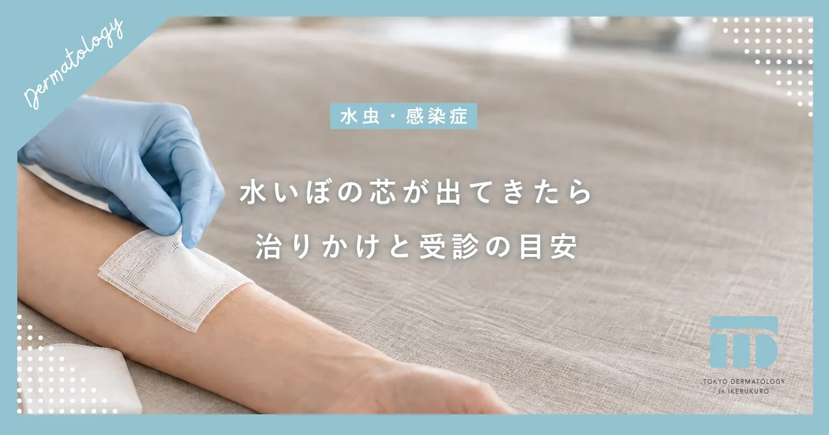 【水いぼの芯が出てきたら】治りかけのサイン？感染を広げないための注意点