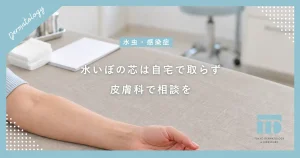 水いぼの白い芯の取り方は？自宅でできる？潰すリスクと皮膚科での安全な処置