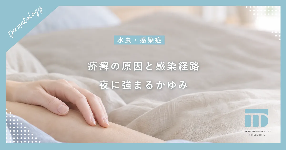 【疥癬の原因とは】ヒゼンダニの感染経路と夜に激しくなるかゆみのメカニズム