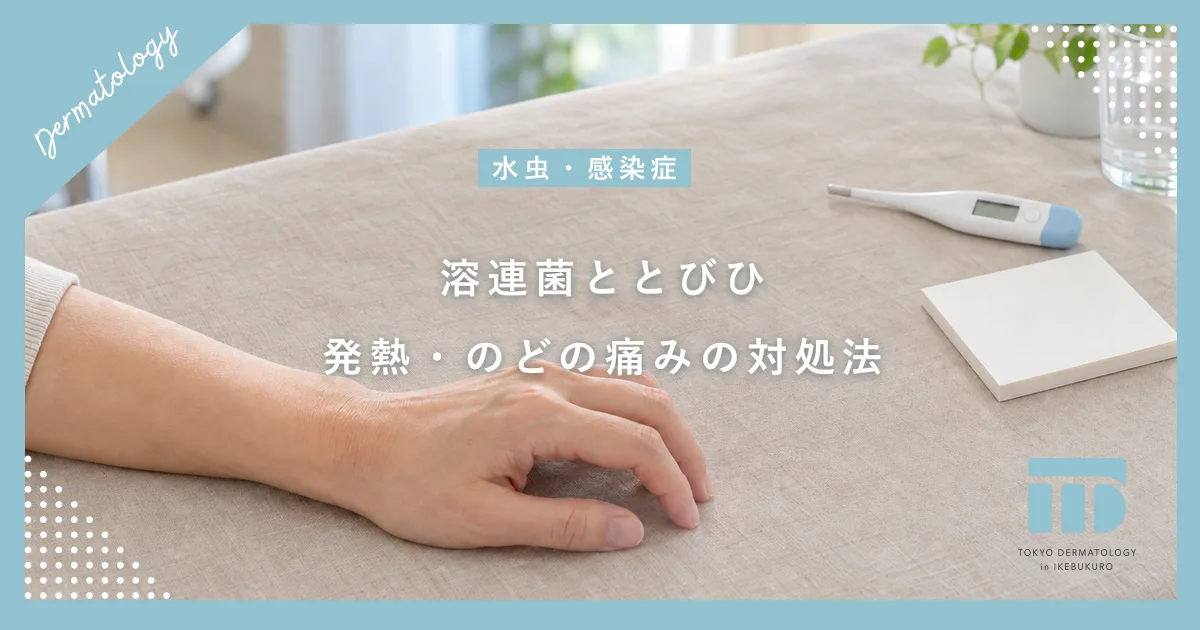 溶連菌が原因のとびひ（膿痂疹）に注意！喉の痛みや発熱を伴う時の対処法