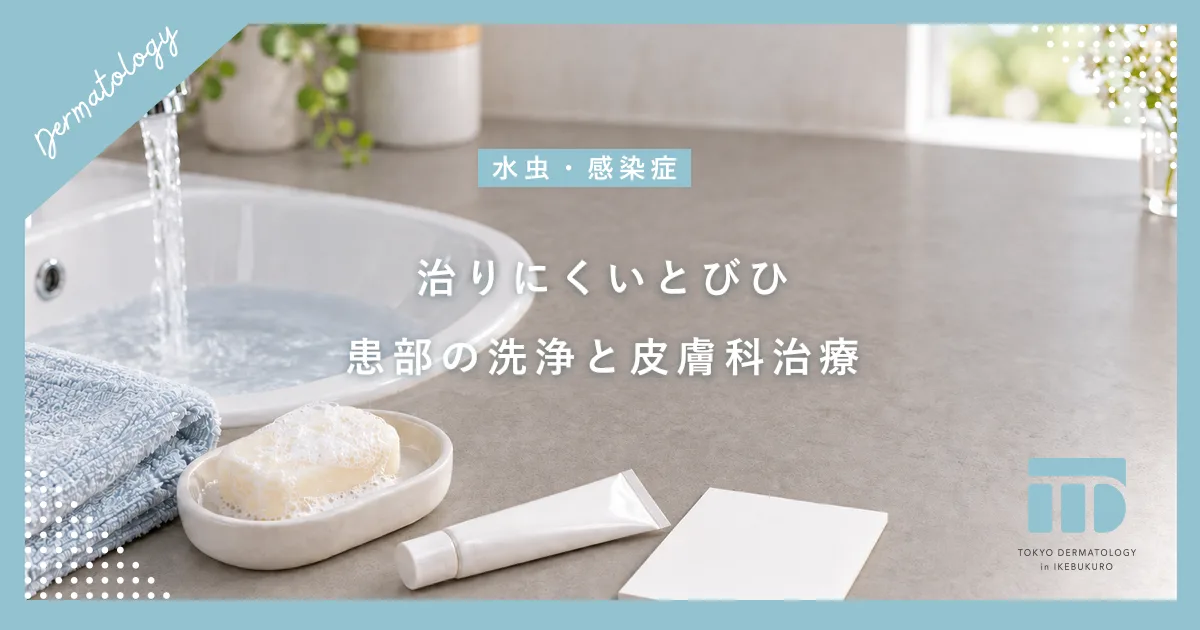 なかなか治らないとびひの治し方!患部を洗う重要性と皮膚科での専門治療