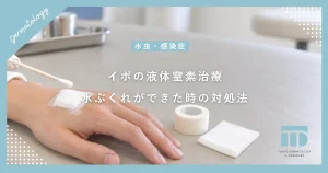 イボの液体窒素治療（凍結療法）とは？効果的なやり方と水ぶくれができた時の対処法
