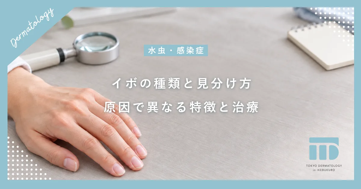 【イボの種類と見分け方】ウイルス性から加齢性まで!原因別の特徴と正しい皮膚科治療