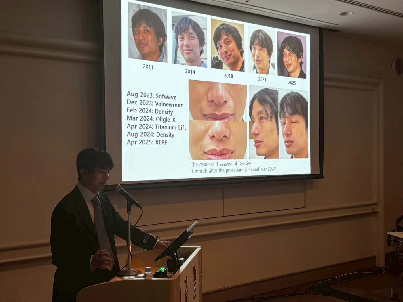 第124回日本皮膚科学会総会 ランチョンセミナー26で、自身がデンシティを受けた経過を示して講演する院長 野田真史